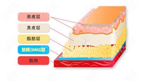 微创拉皮的提升位置