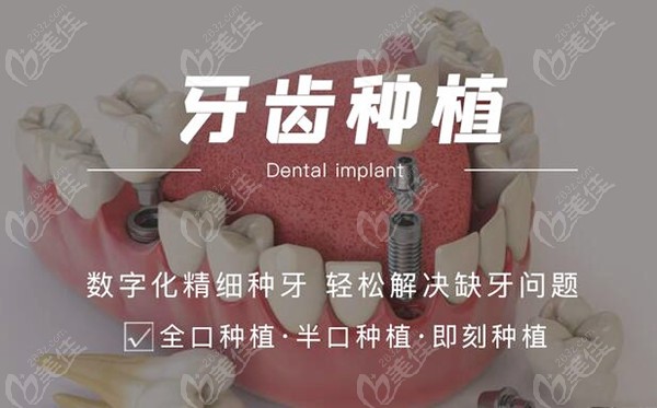 北京京立口腔数字化种植牙