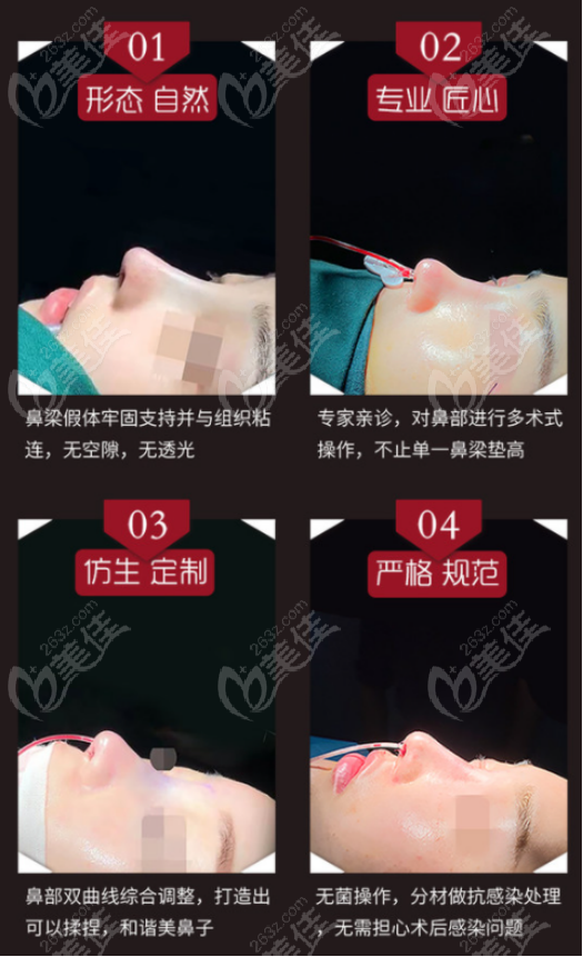 <!--<i data=20240703-sp></i>-->缩鼻翼和缩鼻头的优势