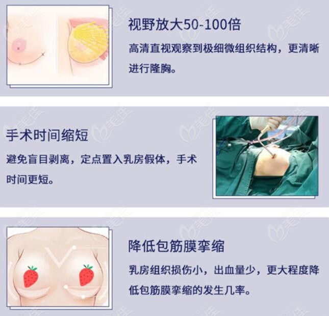 北京丽都医院隆胸技术优势
