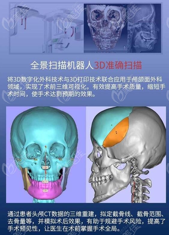 南京医科大学引进的全景扫描机器人做颧骨