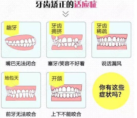 需要矫正的牙齿类型