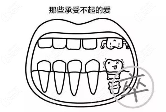 种植体的机械性能会影响植体的咬合力