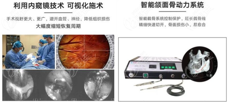 成都友谊的两大技术加快截骨术后恢复