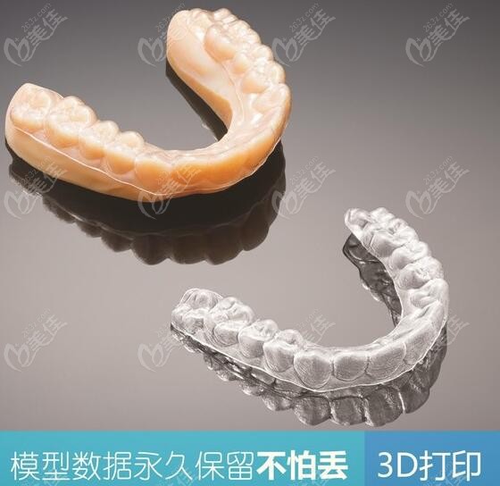 成人牙齒正畸后需要終身佩戴保持器嗎