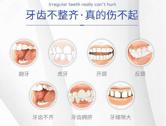 牙齒畸形圖片