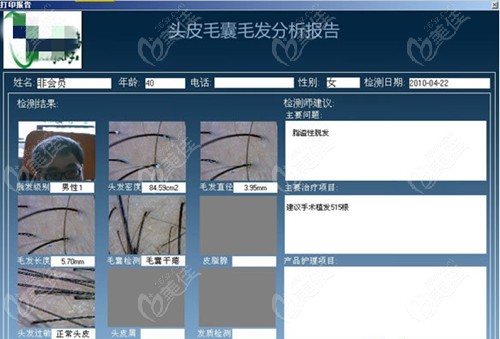 头发毛囊检测分析报告