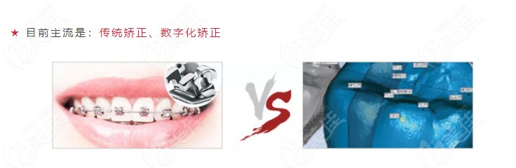 傳統(tǒng)矯正和數(shù)字化矯正哪個好