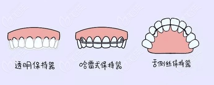 透明和哈雷式以及舌側(cè)絲保持器