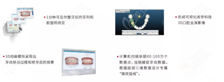 牙齒矯正黑科技iTero口掃設(shè)備