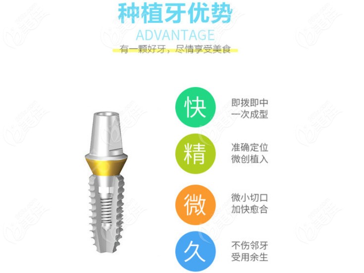 牙齿缺失选择种植牙的优势了解一下