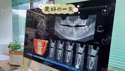 與醫(yī)生聊牙齒矯正方案