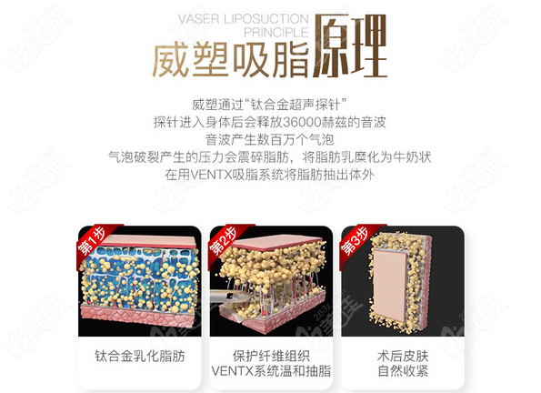 威塑吸脂的原理介绍