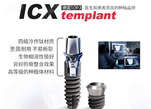 icx种植体外观