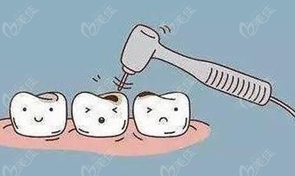 后磨牙根管治疗