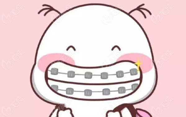spark精靓隐形牙套