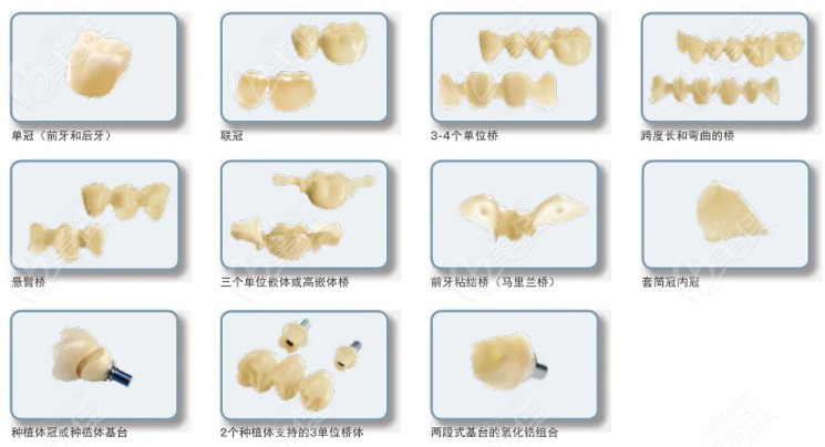 美国lava全瓷牙的适应症有哪些