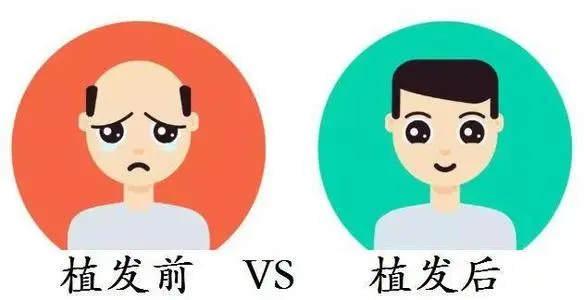 植发可以改善秃顶、头发稀疏、额头高……