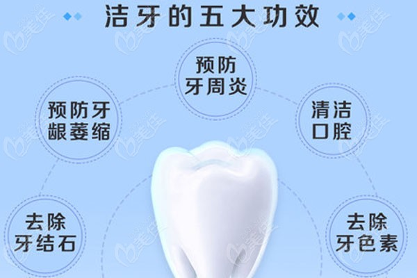 洁牙五大功效