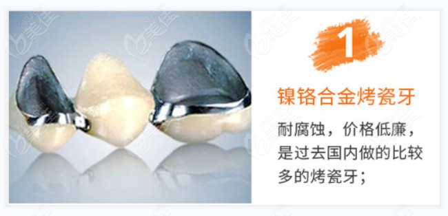 镍铬合金烤瓷牙优缺点