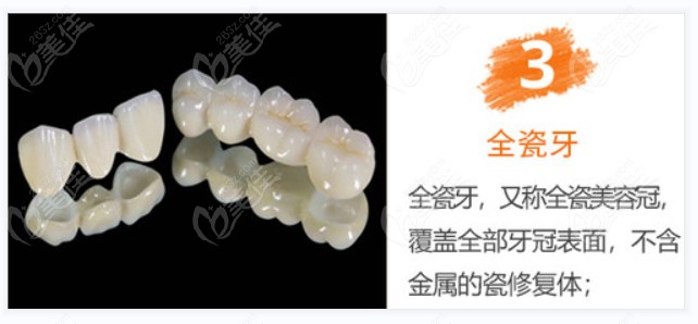 全瓷牙冠的优势都有哪些