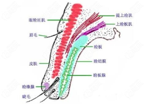 kiss法双眼皮的原理