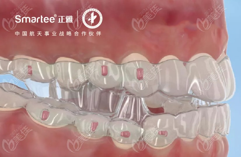 正雅s8的優(yōu)勢(shì)