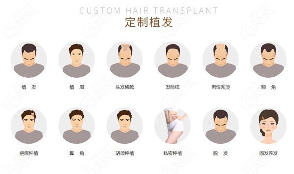 武汉九州丛琳植发包含的服务