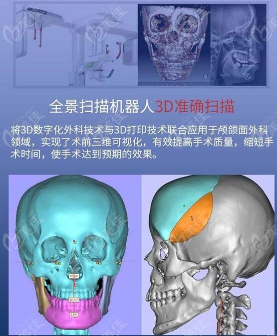 南京友谊全景扫描机器人3D准确扫描