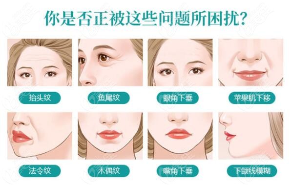 面部衰老症状表现美佳网