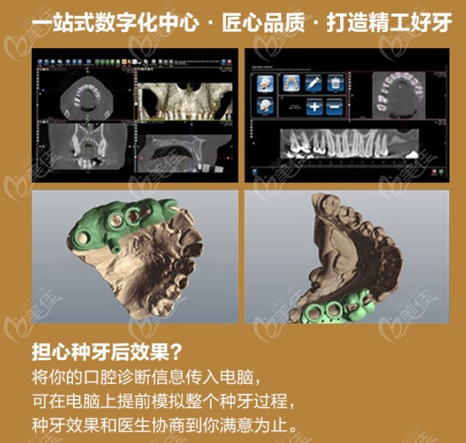 数字化种植牙过程演示