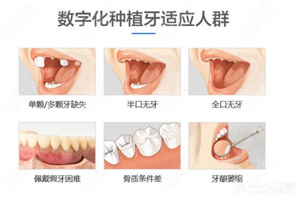 北京科尔口腔种植牙
