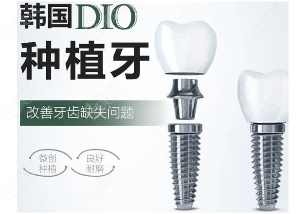 象山丹城口腔医院韩国DIO种植牙的优势