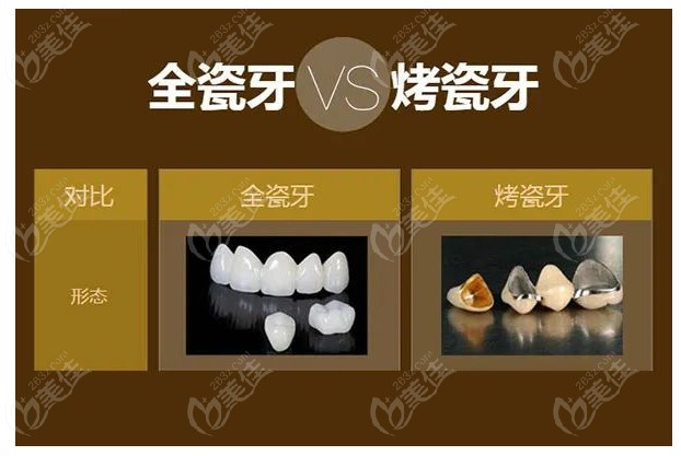 全瓷牙及烤瓷牙在形态上对比如下