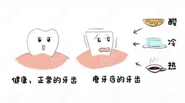 正常牙齿和磨牙的牙齿