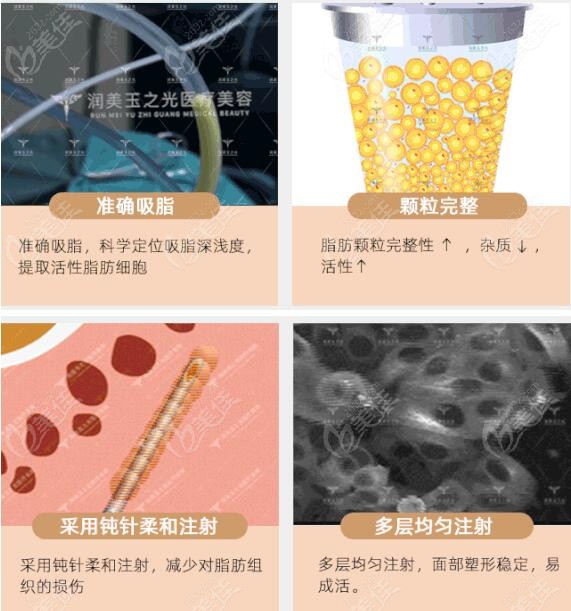 王明利脂肪填充技術(shù)優(yōu)勢(shì) 王明利脂肪填充技術(shù)優(yōu)勢(shì)