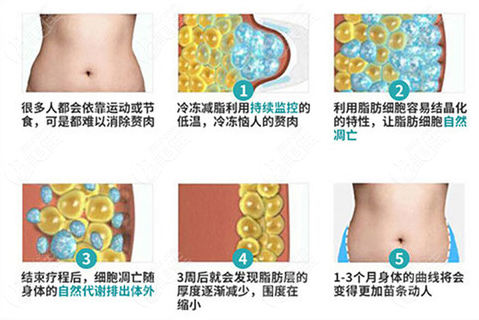 贵阳华美紫馨做酷塑冷冻溶脂 瘦脸怎么样 技术 贵阳华美紫馨做酷塑冷冻溶脂 瘦脸怎么样 技术