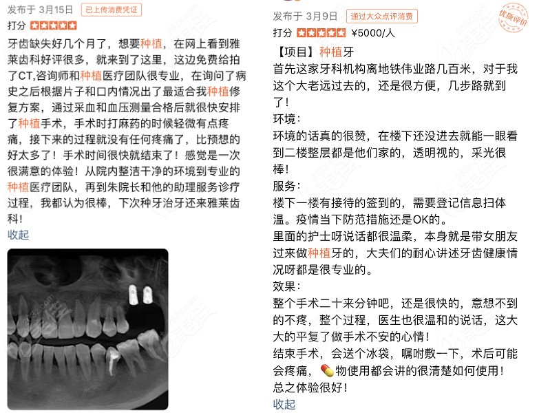 到杭州雅莱口腔做种植牙顾客的评价