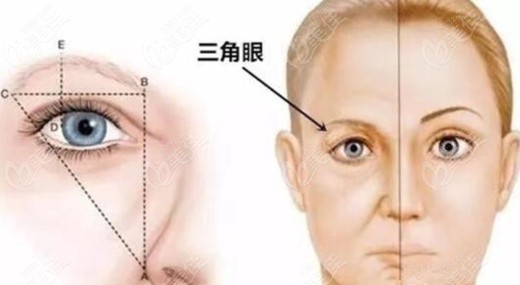 沈阳提眉哪家医院好