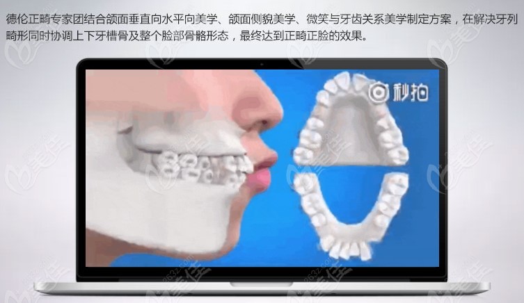 德伦口腔做牙齿矫正的特色