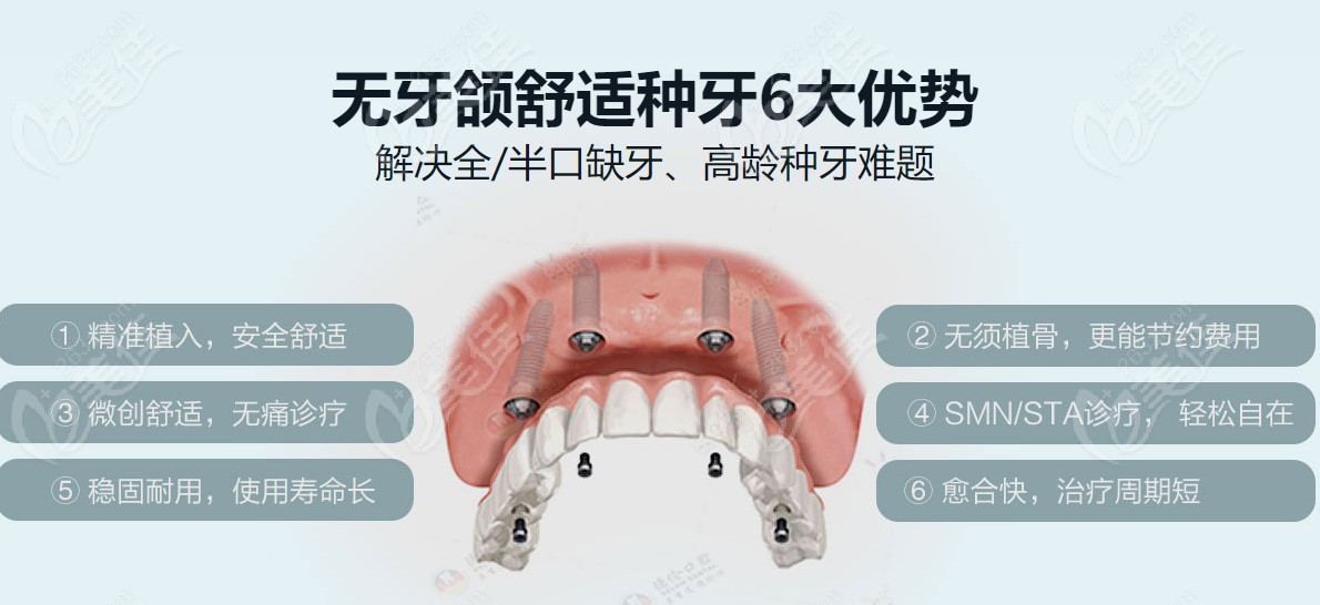 德伦口腔做全口种植牙特色技术优势