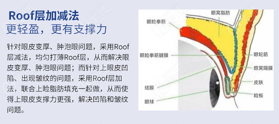 重慶百達麗修復雙眼皮的優勢