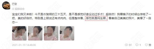 南宁格林美菲双眼皮好吗