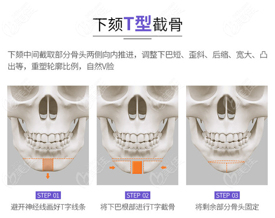 下颏与下颌的区别图片