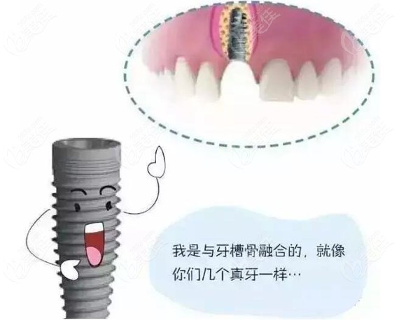 <!--<i data=20240703-sp></i>-->种植牙价格表