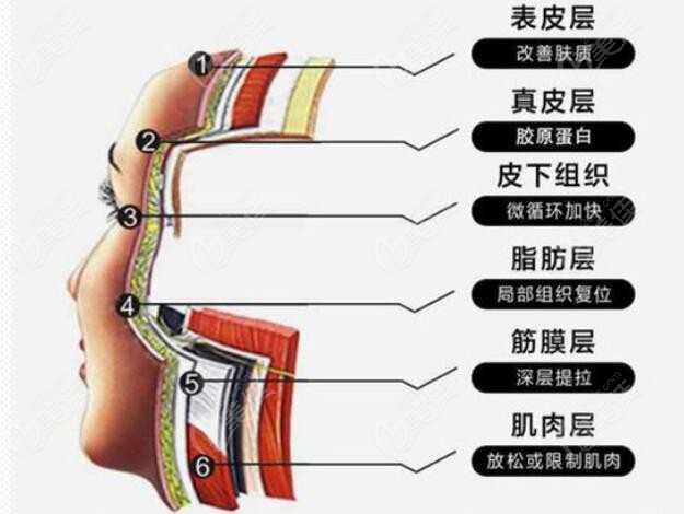 穆宝安 面部五层提升术技术特点