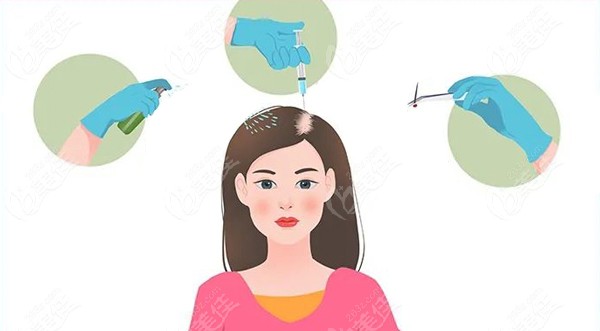 产后脱发怎么办