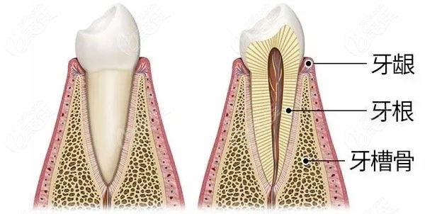 1,部分人群牙槽骨萎缩,需要进行骨粉种植,正常情况每颗牙齿植入的骨粉