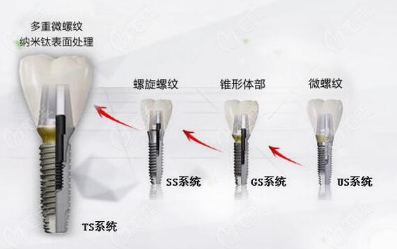 韩系奥齿泰3种型号，规格多