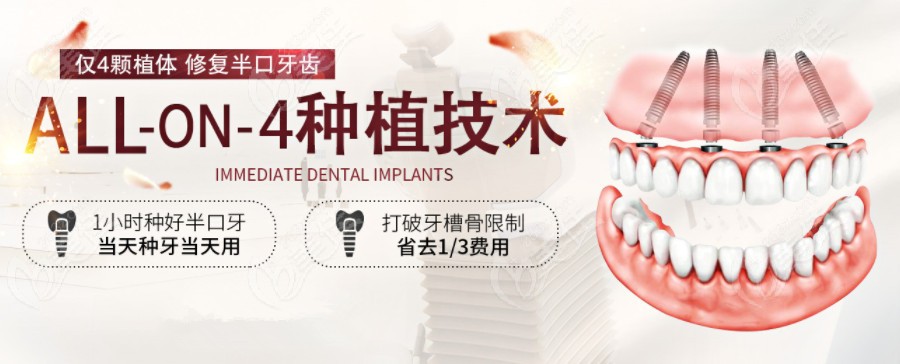 all-on-4全口種植牙的優(yōu)勢(shì)